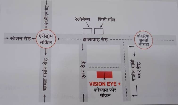 VISION EYE PLUS 